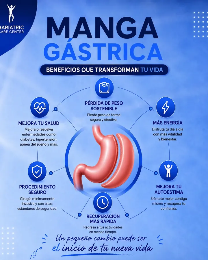Gastric sleeve: benefits that change your life
