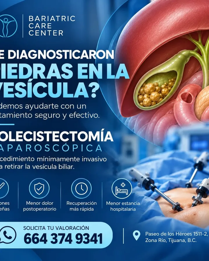 Diagnosed with gallstones? Laparoscopic cholecystectomy