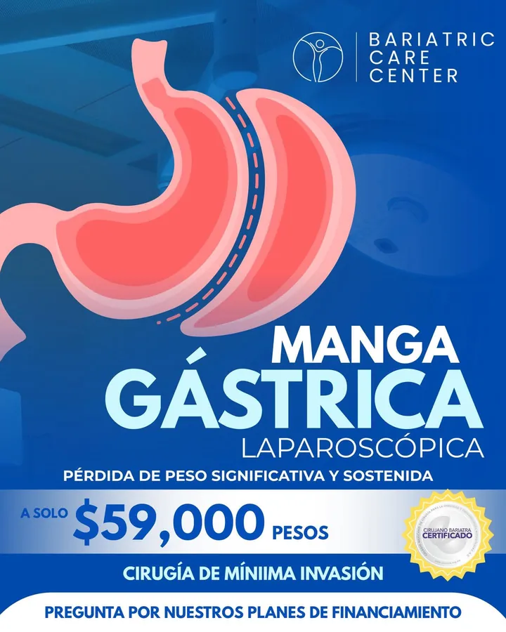 Laparoscopic gastric sleeve: significant, sustained weight loss