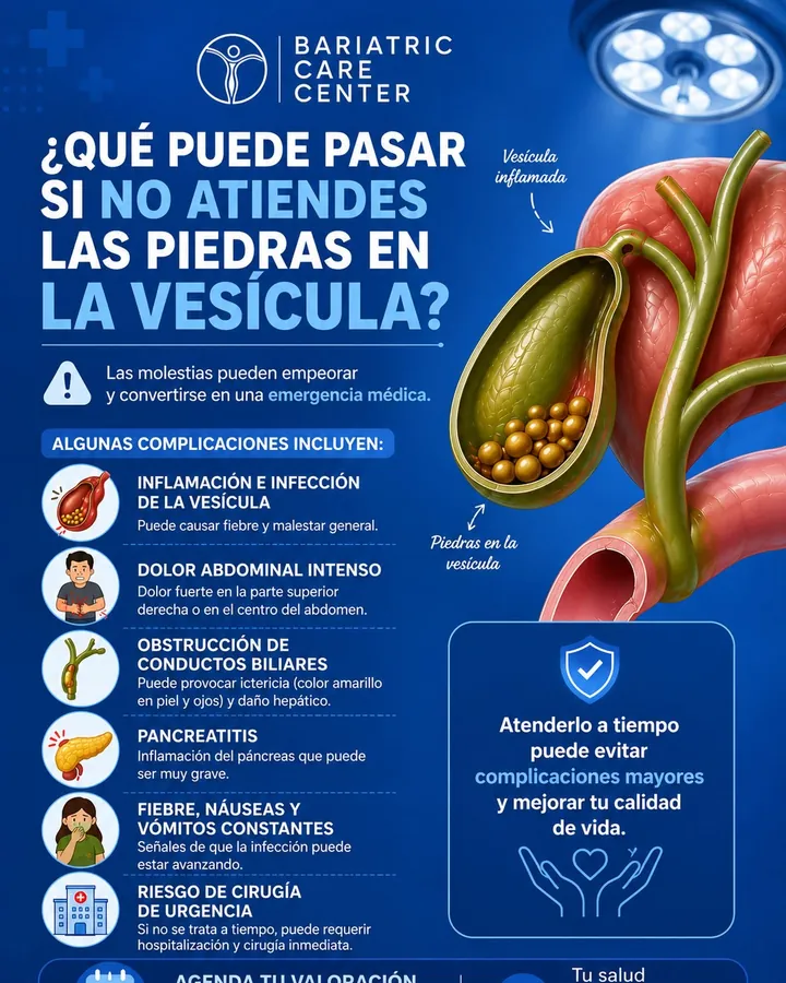 What can happen if gallstones go untreated?